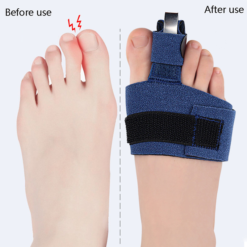 1 Pezzo Correttore per Dita de - Ankle Brace Sock recensione e prezzo